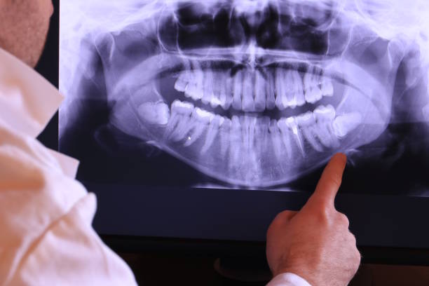 Best Urgent Care for Lost Fillings or Crowns in Buckeystown, MD